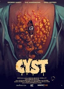 فيلم Cyst 2020 مترجم اون لاين